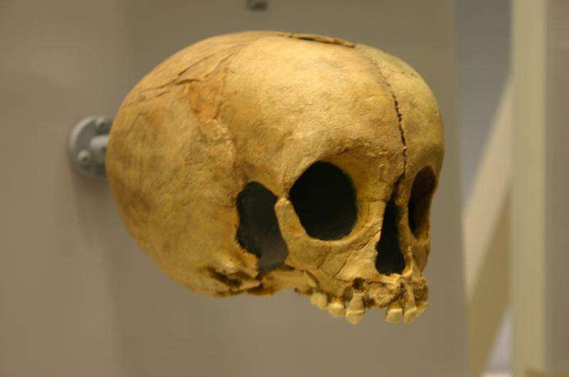 Gisement préhistorique du Pech de l'Azé